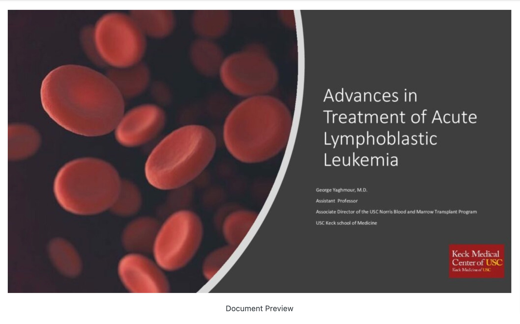 Advance in Treatment of Acute Lymphocyctic Leukemia