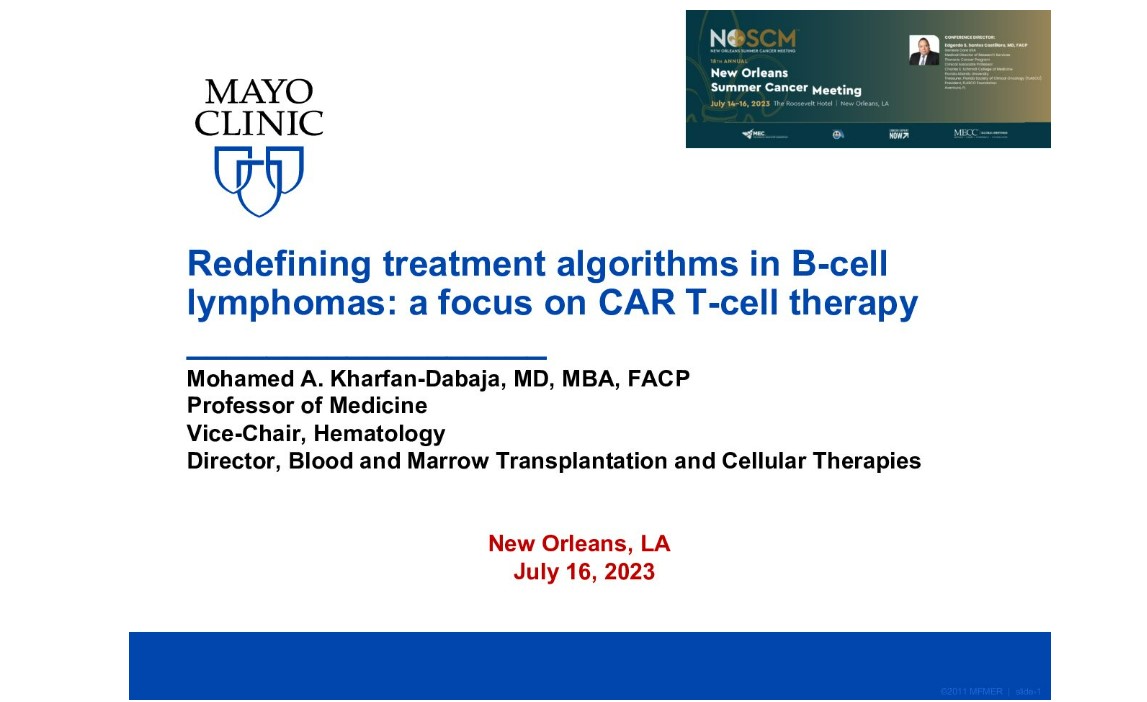 Redefining Treatment Algorithms in B-cell Lymphomas: A Focus on CAR-T Cell TherapyLymphoma