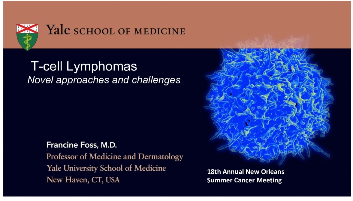 T-Cell NHL: Novel Approaches & Challenges