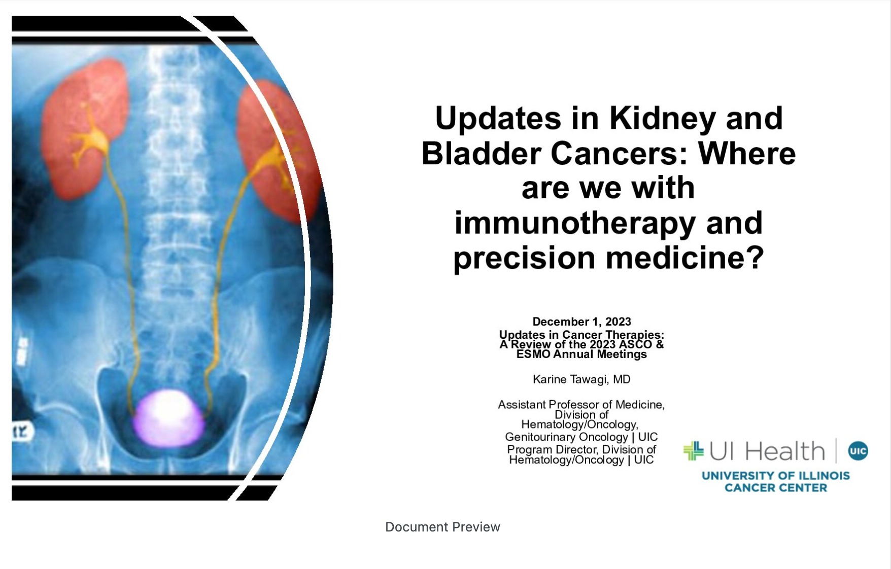 Updates in Kidney and Bladder Cancers: Where we are with Immunotherapy and Precision Medicine?