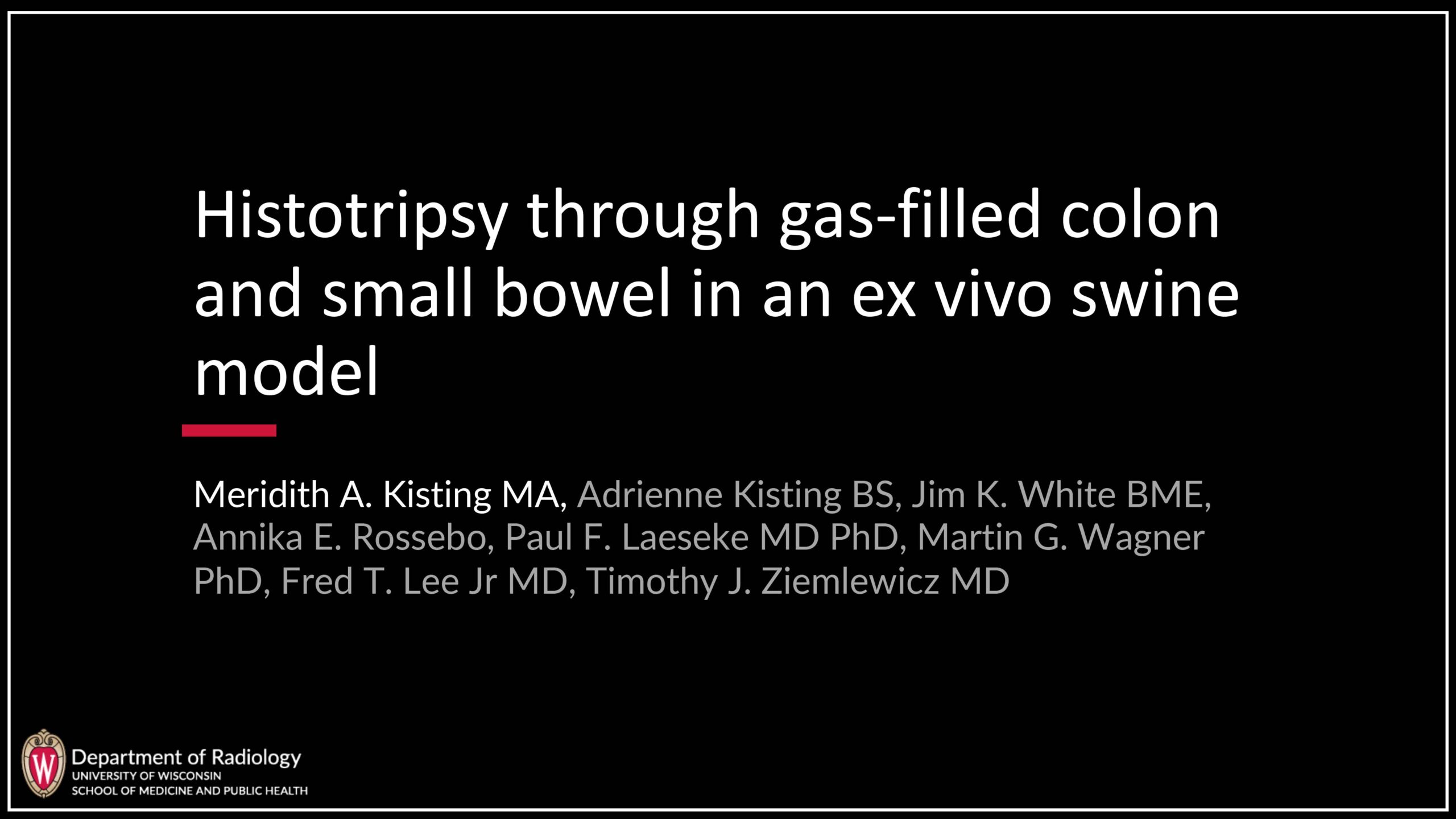 Histotripsy Through Gas-Filled Colon and Small Bowel in an Ex Vivo Swine Model