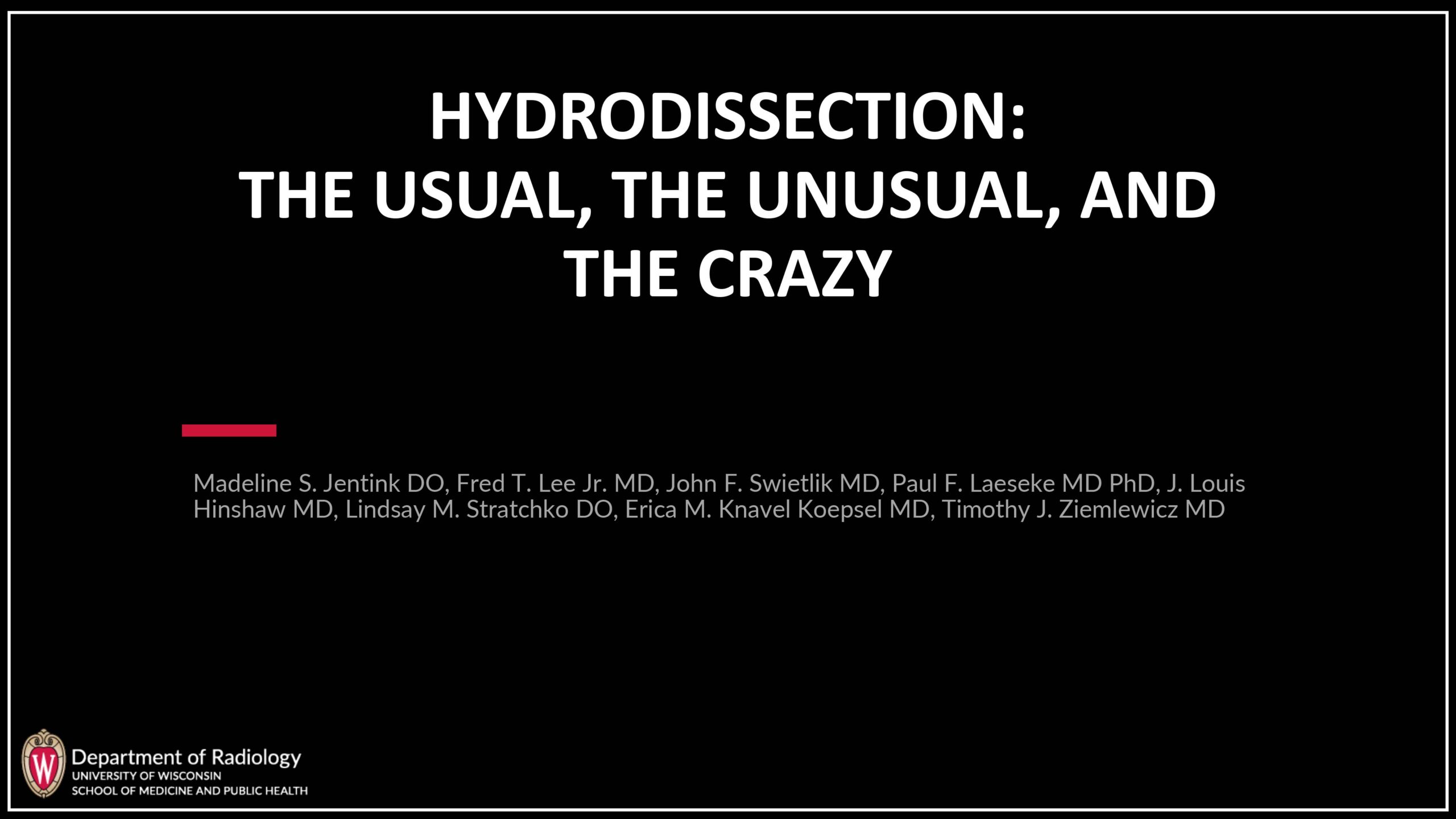 Hydrodissection for Tumor Ablation: The Usual, the Unusual, and the Crazy