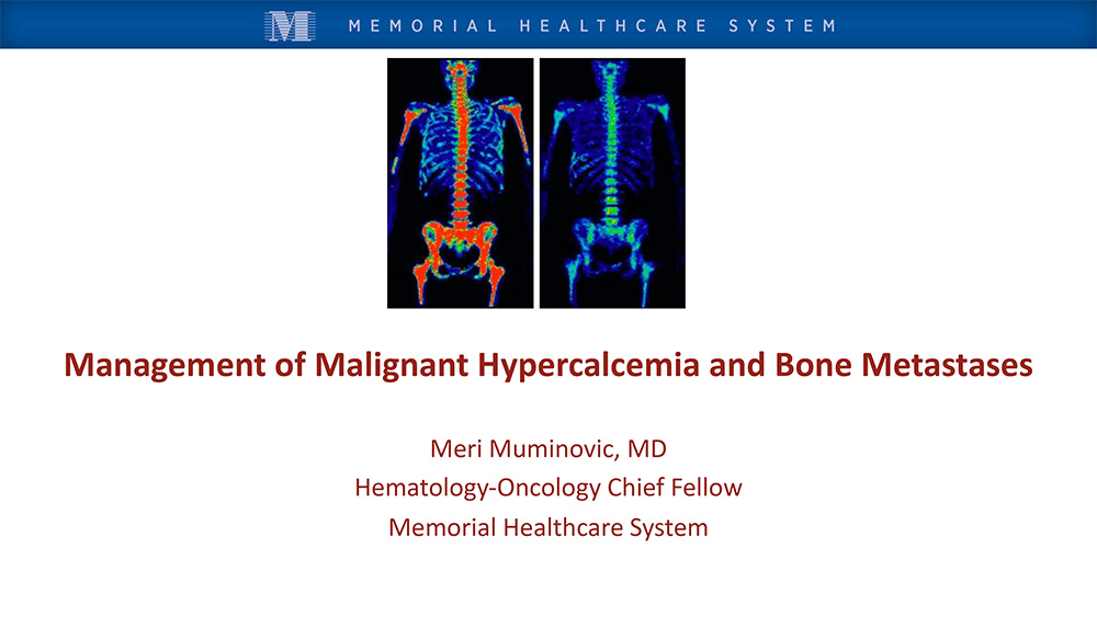 Management of Malignant Hypercalcemia, Bone Metastases & Standard Precautions to Decrease Adverse Events