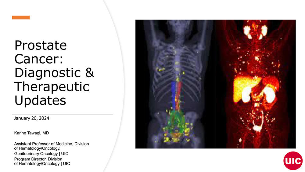 Prostate Cancer: Diagnostic and Therapeutic Updates