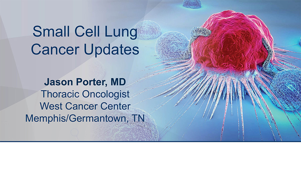 Small Cell Lung Cancer