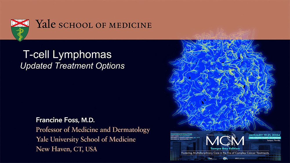 T-Cell NHL- Novel Therapies