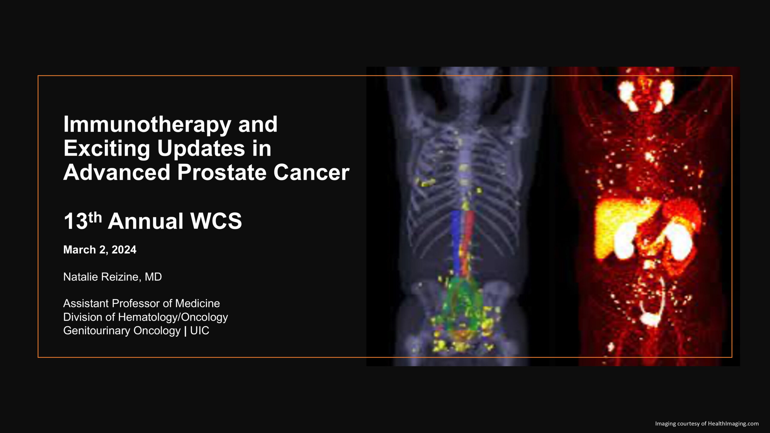 Immunotherapy and Exciting Updates in Advanced Prostate Cancer