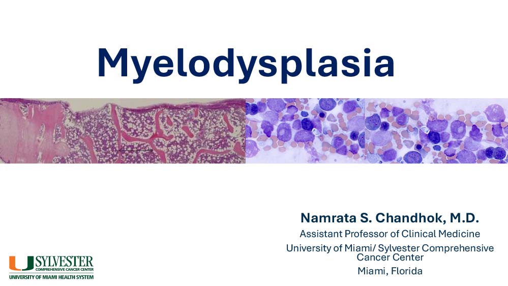 Myelodysplasia