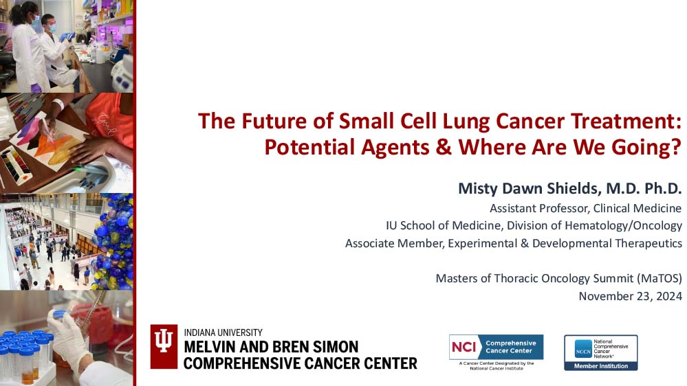 The Future of SCLC Treatment: Potential Agents and Where Are We Going?